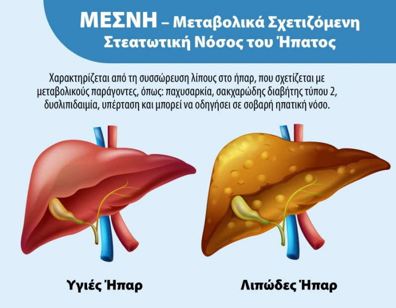 Λιπώδες_Ήπαρ_φωτό_1_3905c.jpg