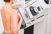 Καμπανάκι από ΠΙΣ: Ανεκτέλεστο το 60% των παραπεμπτικών για μαστογραφία