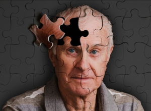 Επιδιόρθωση μνήμης σε ασθενείς με Αλτσχάιμερ - Τι ανακάλυψαν επιστήμονες
