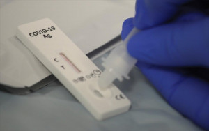 Υπ. Εργασίας: Τρία δωρεάν self test από τα φαρμακεία για την περίοδο 7 έως 30 Ιουνίου