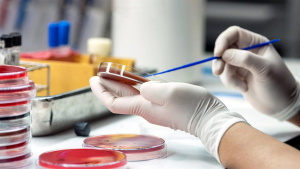 Κλιμάκιο του ΕΟΔΥ στην Πάτρα - Νέο κρούσμα μηνιγγίτιδας σε φοιτητή