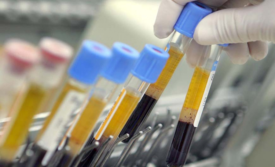 Σαρηγιάννης: Μπορεί να φτάσουμε και 5000 κρούσματα μέχρι τέλος Αυγούστου