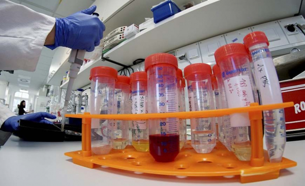 Κορονοϊός: Σήμερα παραλαμβάνει η Ελλάδα 2.000 μονοκλωνικά αντισώματα