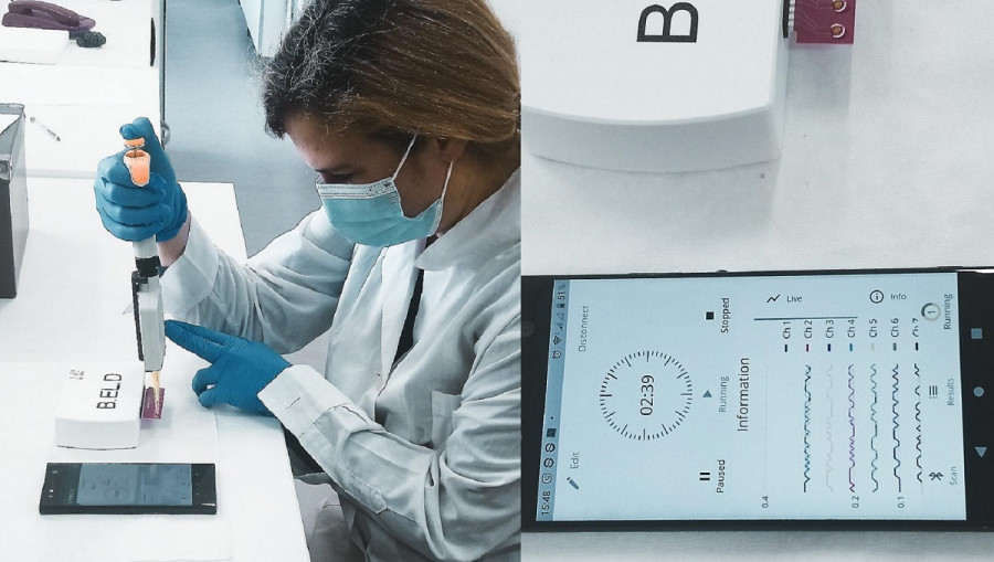 Στο 97,8% η ακρίβεια διάγνωσης του κορονοϊού με τον βιοαισθητήρα του Γεωπονικού Πανεπιστημίου Αθηνών
