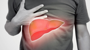 Υγεία: Η λιπώδης νόσος του ήπατος συνδέεται με αυξημένο κίνδυνο θανάτου