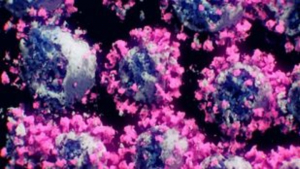 Μόσιαλος: Η Όμικρον προκαλεί ήπια ασθένεια, σύμφωνα με τα έως τώρα στοιχεία