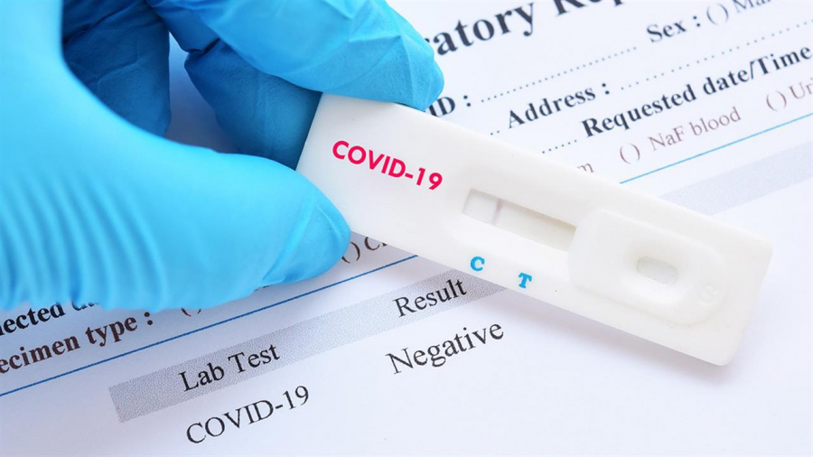Δωρεάν rapid test από το Δήμο Αθηναίων στα δημοτικά ιατρεία