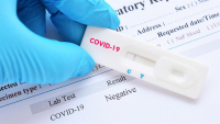 Δωρεάν rapid test από το Δήμο Αθηναίων στα δημοτικά ιατρεία