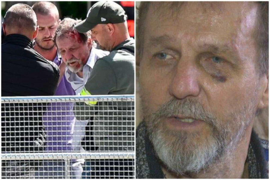Σλοβακία: Ένας "οργισμένος ποιητής", ο φερόμενος ως δράστης της επίθεσης, εναντίον του πρωθυπουργού