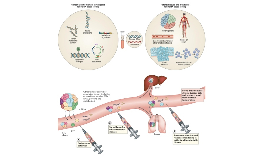 Υγρή βιοψία: Επαναπροσδιορίζοντας τη διαγνωστική και εξατομικευμένη θεραπεία στον καρκίνο