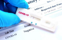 Self Tests: Υποχρέωση των εργοδοτών να προμηθεύονται 1 την εβδομάδα ανά εργαζόμενο