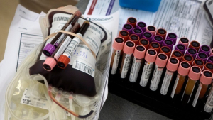 Πού μπορούμε να προσφέρουμε αίμα για τους τραυματίες των Τεμπών