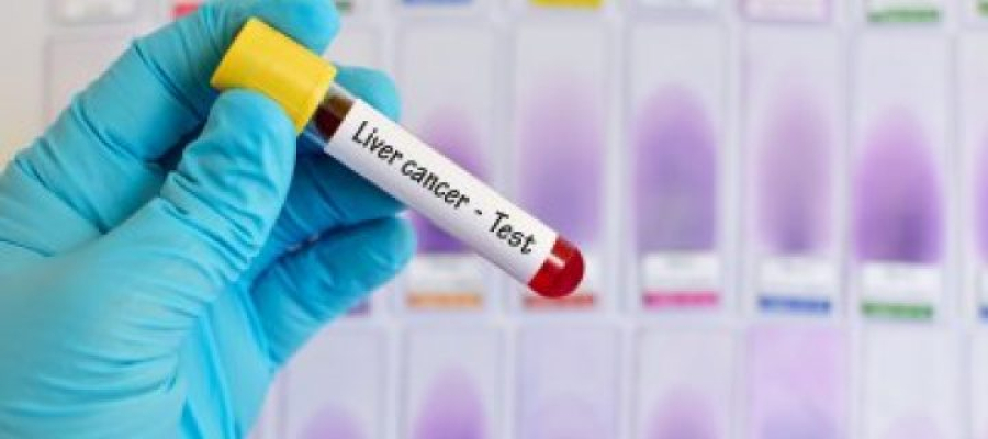 Υγεία: Τα κρούσματα καρκίνου του ήπατος αναμένεται να αυξηθούν κατά 55% έως το 2040